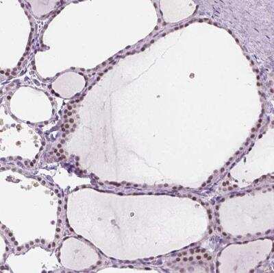 Immunohistochemistry-Paraffin: ZMAT4 Antibody [NBP2-49619]