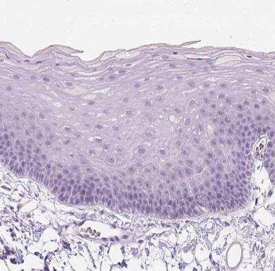 Immunohistochemistry-Paraffin: ZMAT4 Antibody [NBP2-49619]