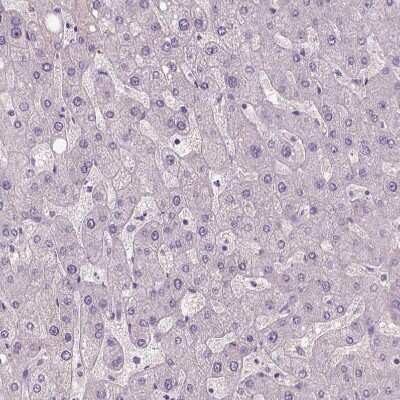 Immunohistochemistry-Paraffin: ZMAT4 Antibody [NBP2-49619]