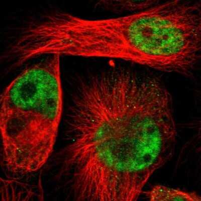 Immunocytochemistry/ Immunofluorescence: ZMAT5 Antibody [NBP1-85794]