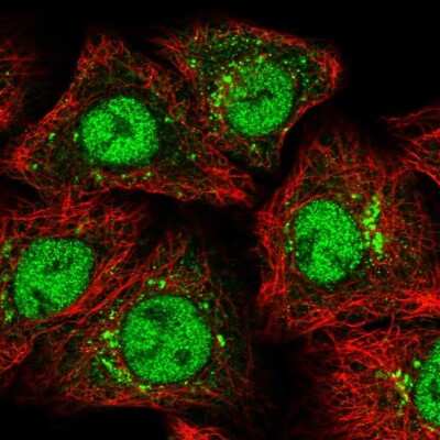 Immunocytochemistry/ Immunofluorescence: ZMIZ1/Zimp10 Antibody [NBP1-92610]