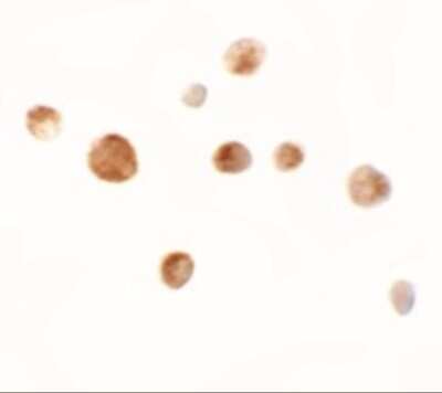 Immunocytochemistry/ Immunofluorescence: ZMIZ1/Zimp10 Antibody - BSA Free [NBP1-76553]