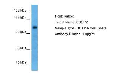 Western Blot: ZMIZ1/Zimp10 Antibody [NBP2-88638]