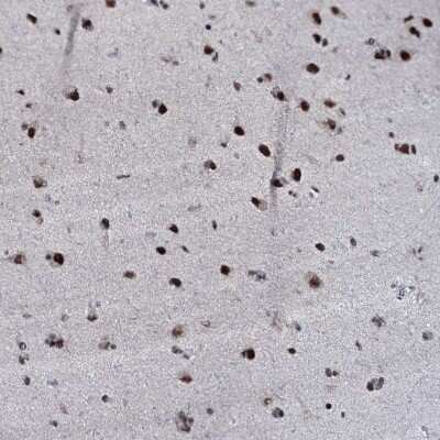 Immunohistochemistry-Paraffin: ZMIZ2 Antibody [NBP1-85032]