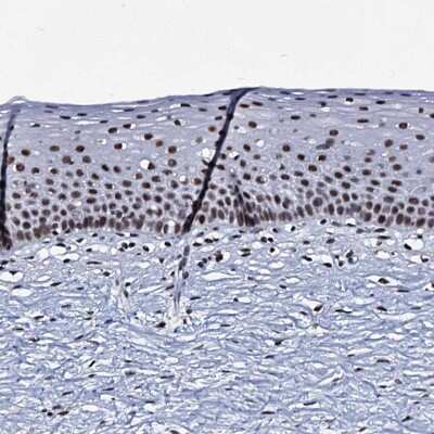 Immunohistochemistry-Paraffin: ZMIZ2 Antibody [NBP1-85032]