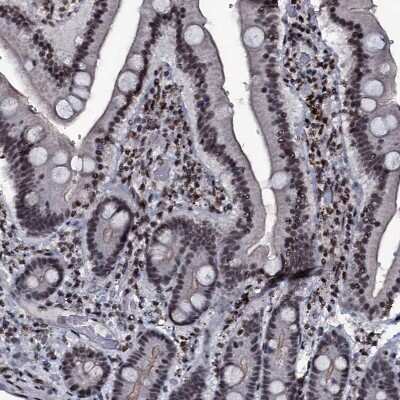 Immunohistochemistry-Paraffin: ZMIZ2 Antibody [NBP1-85032]
