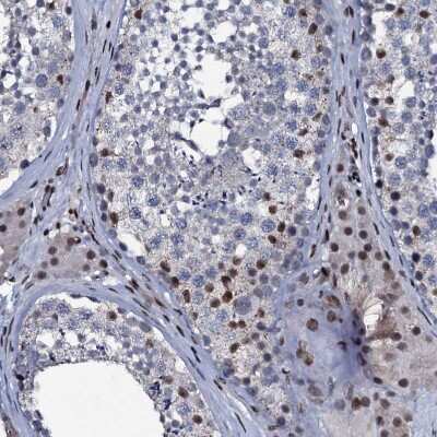 Immunohistochemistry-Paraffin: ZMIZ2 Antibody [NBP1-85032]