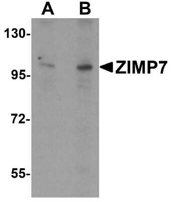 Western Blot: ZMIZ2 AntibodyBSA Free [NBP1-76552]