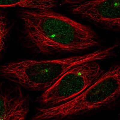Immunocytochemistry/ Immunofluorescence: ZMYM1 Antibody [NBP2-55906]