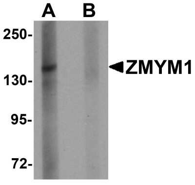 Western Blot: ZMYM1 AntibodyBSA Free [NBP1-76523]