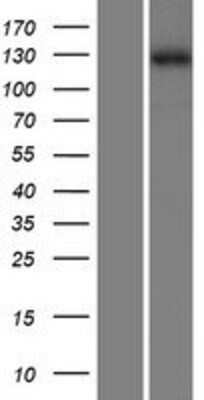 Western Blot: ZMYM1 Overexpression Lysate [NBP2-06289]