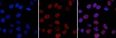 Immunocytochemistry/ Immunofluorescence: ZMYM3 Antibody (C.15200016) [NBP2-59244]