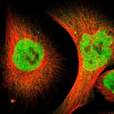 Immunocytochemistry/ Immunofluorescence: ZMYM3 Antibody [NBP1-84952]