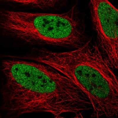 Immunocytochemistry/ Immunofluorescence: ZMYM3 Antibody [NBP2-69004]
