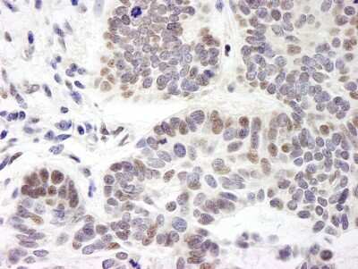 Immunohistochemistry-Paraffin: ZMYM3 Antibody [NB100-458]