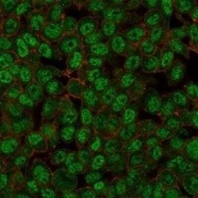 Immunocytochemistry/ Immunofluorescence: ZMYM3 Antibody (PCRP-ZMYM3-2F10) [NBP3-07551]