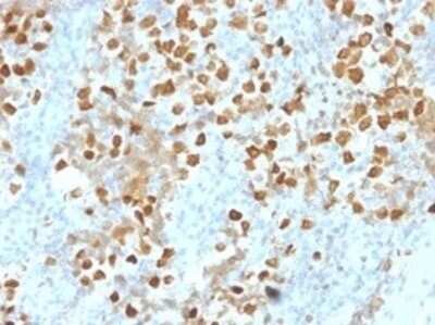 Immunohistochemistry-Paraffin: ZMYM3 Antibody (PCRP-ZMYM3-2F10) [NBP3-07551]
