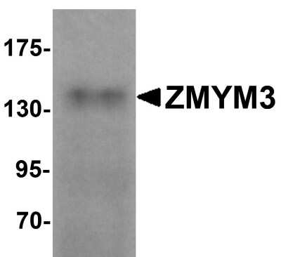 Western Blot: ZMYM3 AntibodyBSA Free [NBP1-76525]
