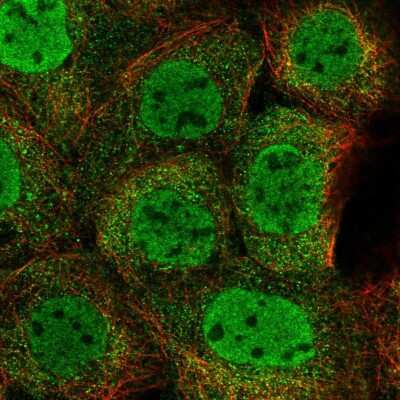 Immunocytochemistry/ Immunofluorescence: ZMYM4 Antibody [NBP2-58244]