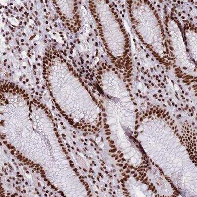 Immunohistochemistry-Paraffin: ZMYM6NB Antibody [NBP2-14717]