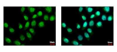 Immunocytochemistry/ Immunofluorescence: ZMYND11 Antibody [NBP2-20960]