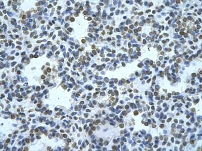 Immunohistochemistry-Paraffin: ZMYND11 Antibody [NBP2-86909]