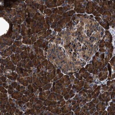 Immunohistochemistry-Paraffin: ZMYND19 Antibody [NBP1-81047]