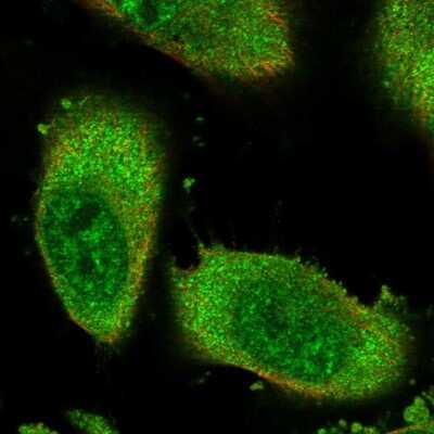 Immunocytochemistry/ Immunofluorescence: ZNF114 Antibody [NBP1-81181]