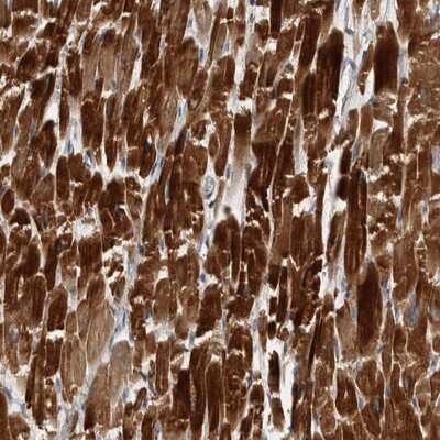 Immunohistochemistry-Paraffin: ZNF114 Antibody [NBP1-81181]
