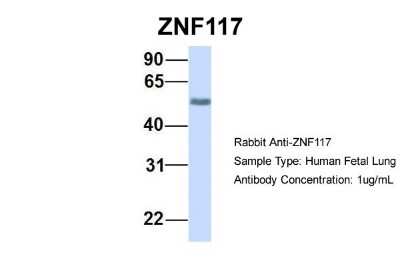Western Blot: ZNF117 Antibody [NBP1-79243]