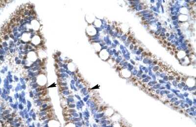Immunohistochemistry-Paraffin: ZNF12 Antibody [NBP1-80116]