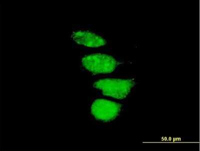 Immunocytochemistry/ Immunofluorescence: ZNF133 Antibody [H00007692-B01P]