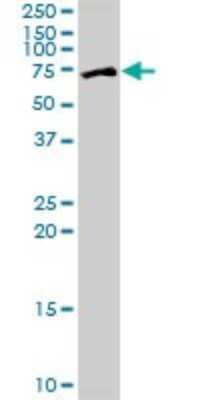 Western Blot: ZNF133 Antibody [H00007692-B02P]