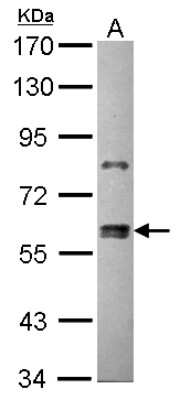 Western Blot: ZNF133 Antibody [NBP2-20963]