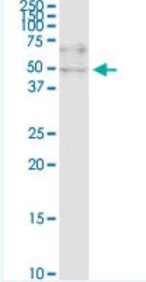 Western Blot: ZNF134 Antibody (2D10) [H00007693-M03-100ug]