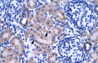 Immunohistochemistry: ZNF134 Antibody [NBP2-86434]