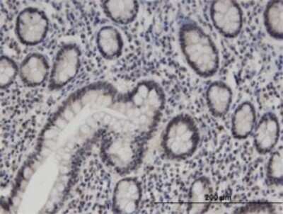 Immunohistochemistry-Paraffin: ZNF138 Antibody (4D11) [H00007697-M01]
