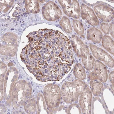 Immunohistochemistry-Paraffin: ZNF14 Antibody [NBP2-13552]