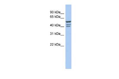 Western Blot: ZNF140 Antibody [NBP2-83824]