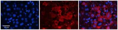 Immunohistochemistry-Paraffin: ZNF142 Antibody [NBP2-83825]