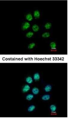 Immunocytochemistry/ Immunofluorescence: ZNF143 Antibody [NBP1-32104]