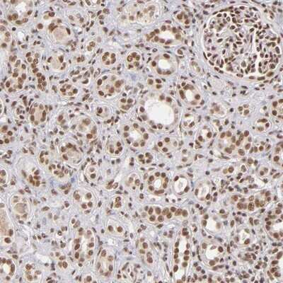 Immunohistochemistry-Paraffin: ZNF148 Antibody [NBP1-88668]