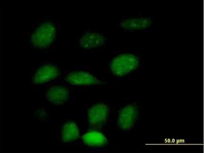 Immunocytochemistry/ Immunofluorescence: ZNF157 Antibody [H00007712-B01P]