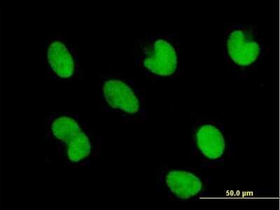 Immunocytochemistry/ Immunofluorescence: ZNF165 Antibody [H00007718-B01P]