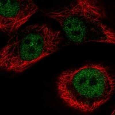 Immunocytochemistry/ Immunofluorescence: ZNF169 Antibody [NBP3-17781]