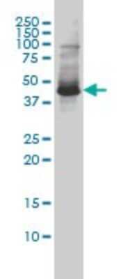 Western Blot: ZNF174 Antibody (2D7-E9) [H00007727-M01]