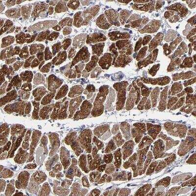 Immunohistochemistry-Paraffin: ZNF175 Antibody [NBP1-80969]