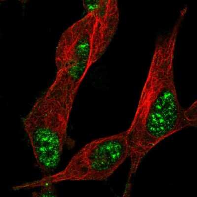 Immunocytochemistry/ Immunofluorescence: ZNF179 Antibody [NBP2-13236]