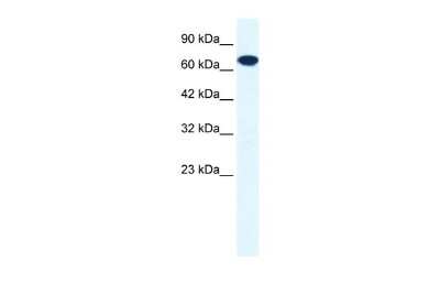 Western Blot: ZNF179 Antibody [NBP2-86448]