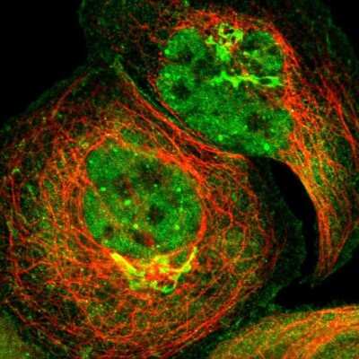 Immunocytochemistry/ Immunofluorescence: ZNF18 Antibody [NBP1-81758]